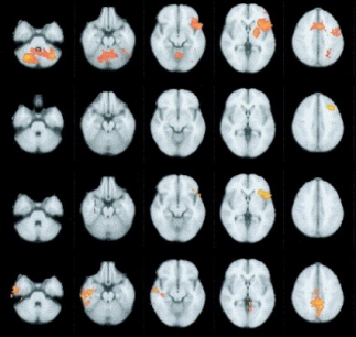 Modern fMRI scans can indicate the location of different brain functions
